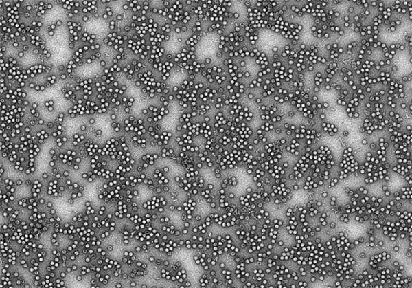 Enterovirus Coxsackievirus B3. Elektronmikroskopi-bild.